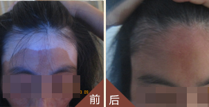 叶群的康复之路
